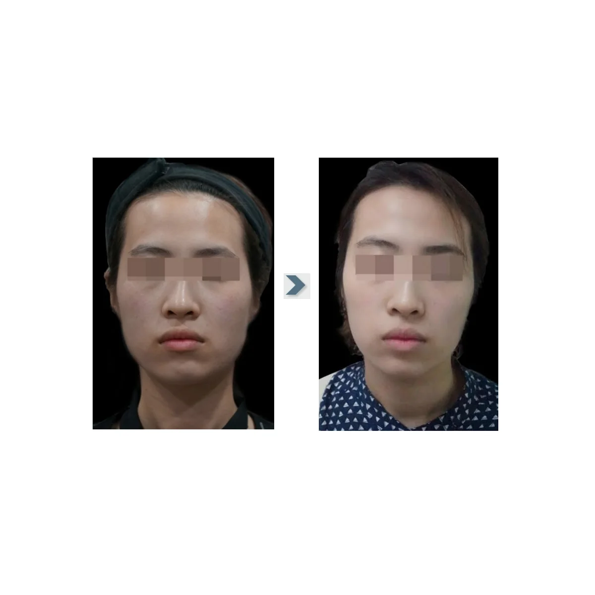 Diamond Shine PDRN - Single | Box of 5 - Image 3