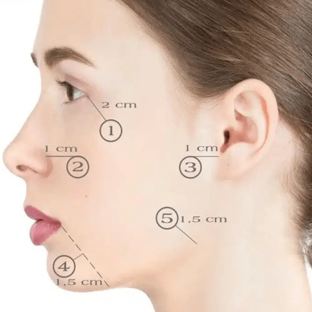 Nucleofill 25 - Biorestructuring - 1.5ml - Image 2